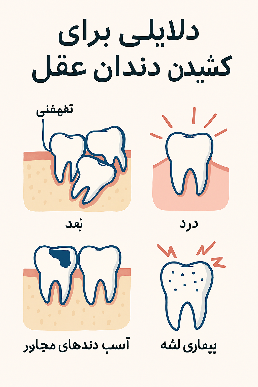 دلایلی برای کشیدن دندان عقل