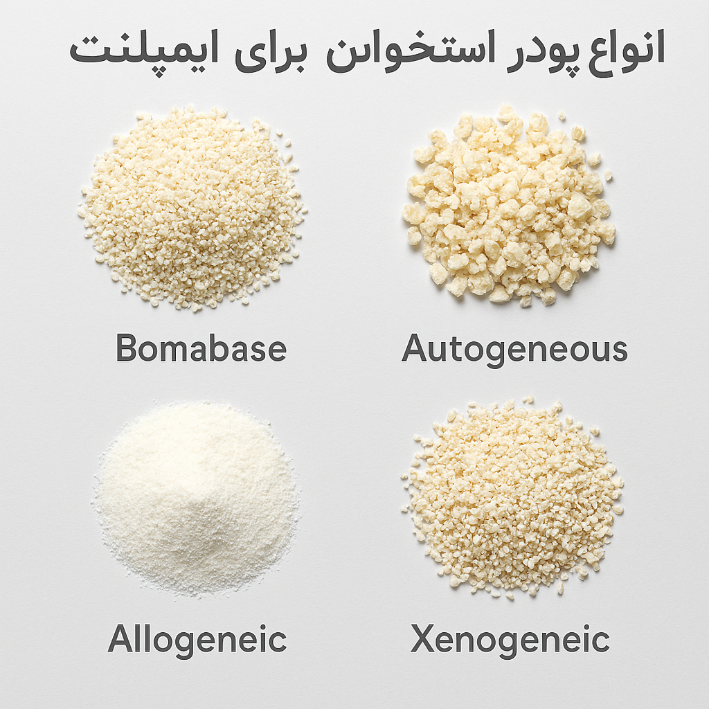 انواع پودر استخوان برای ایمپلنت